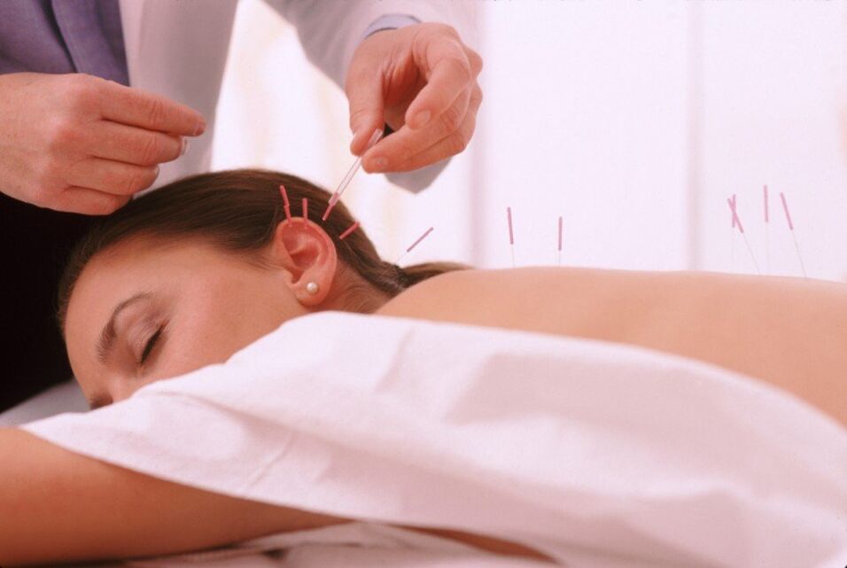 Acupuncture and acupuncture with cervical osteochondrosis