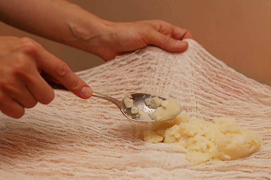 Compress from honey and potatoes