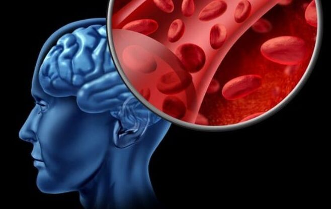 The starvation of the oxygen of the brain